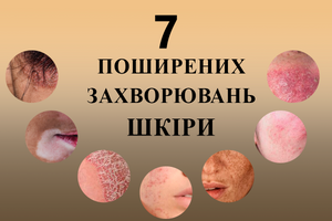 7 поширених захворювань шкіри про які вам потрібно знати